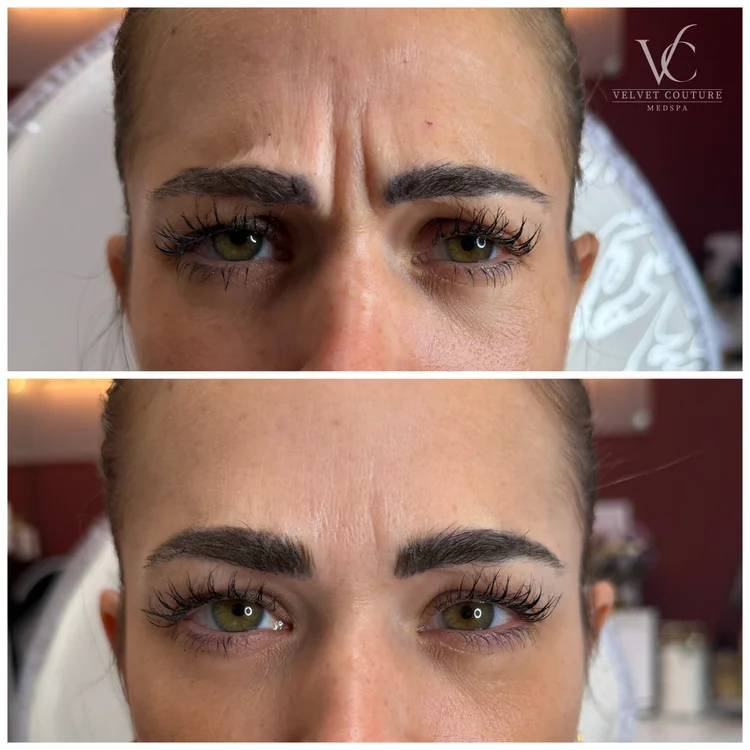 Client before and after, brows. Individual results vary.