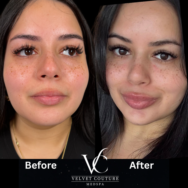 Client before and after, face. Individual results vary.