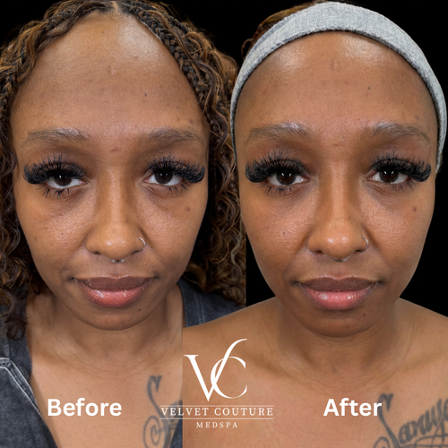 Smooth Lines, before & after, photo 2 of 15