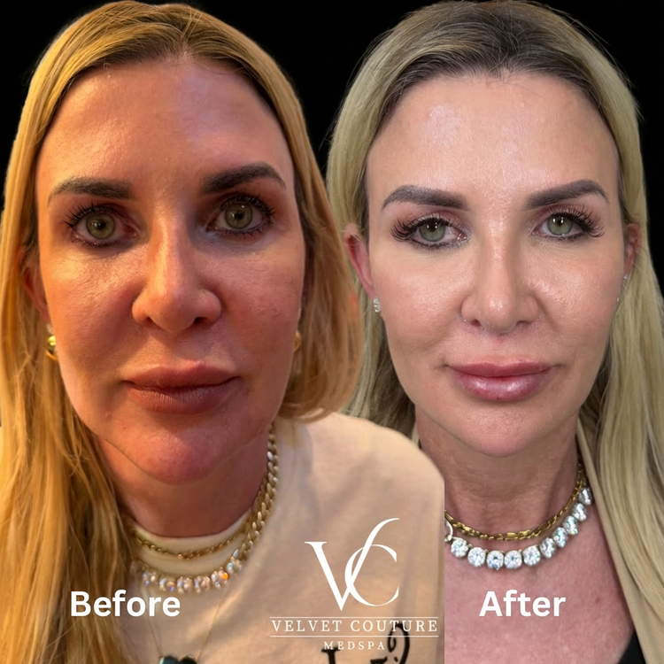 Client before and after, face. Individual results vary.
