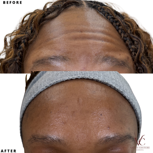 Smooth Lines, before & after, photo 11 of 15