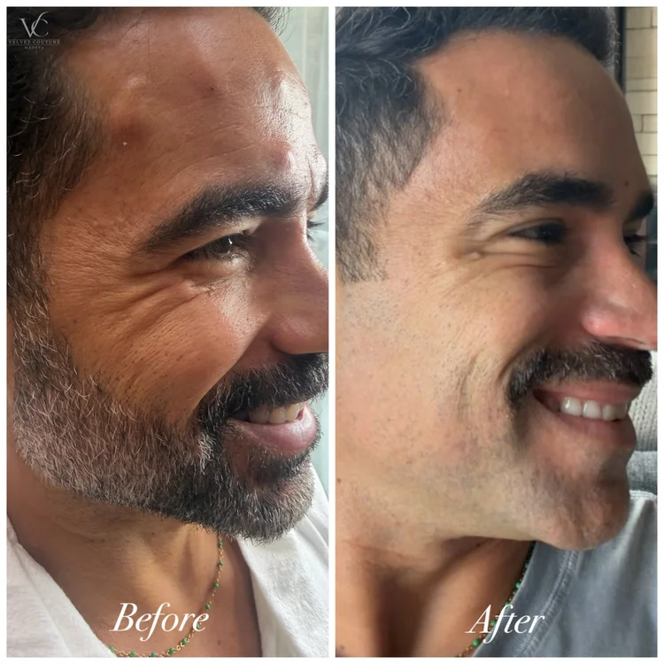 Client before and after, face. Individual results vary.