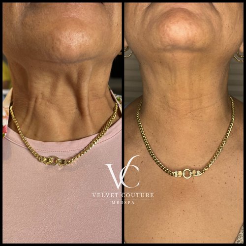Face & Contour, before & after, photo 31 of 31