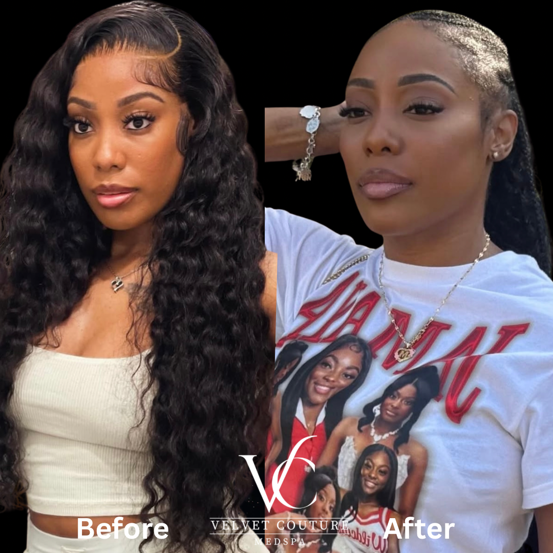 Beige Minimalist Skincare Before and After Instagram Post.png