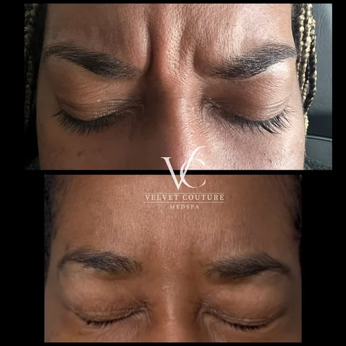 Smooth Lines, before & after, photo 3 of 15