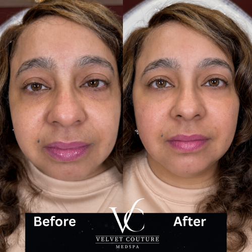 Face & Contour, before & after, photo 10 of 31