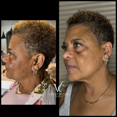 Face & Contour, before & after, photo 19 of 31
