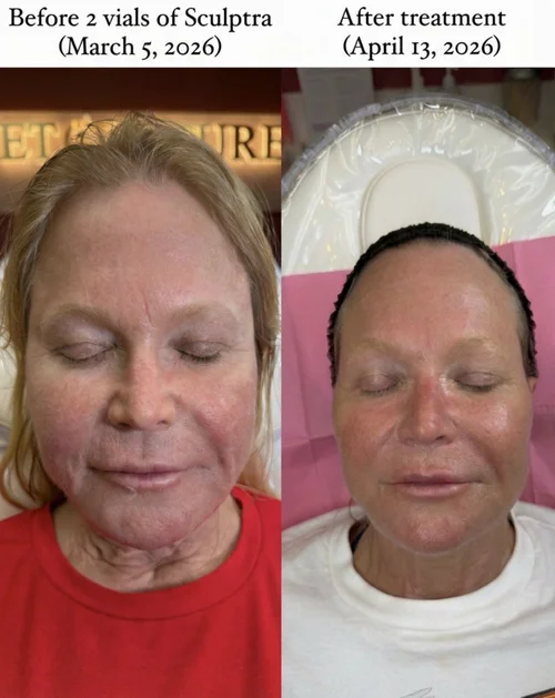 Face & Contour, before & after, photo 30 of 31