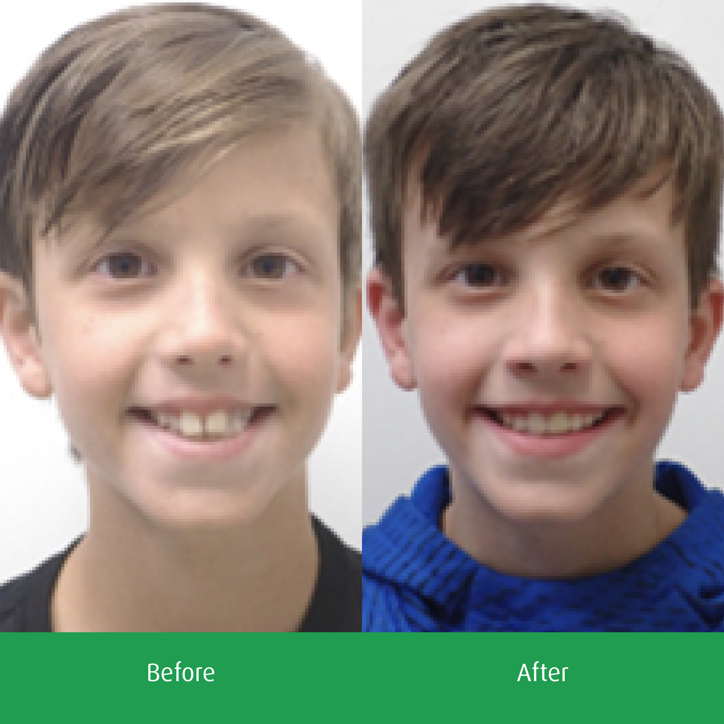 Spring-Orthodontics-Smile-Gallery-See-Our-Smiles3.png