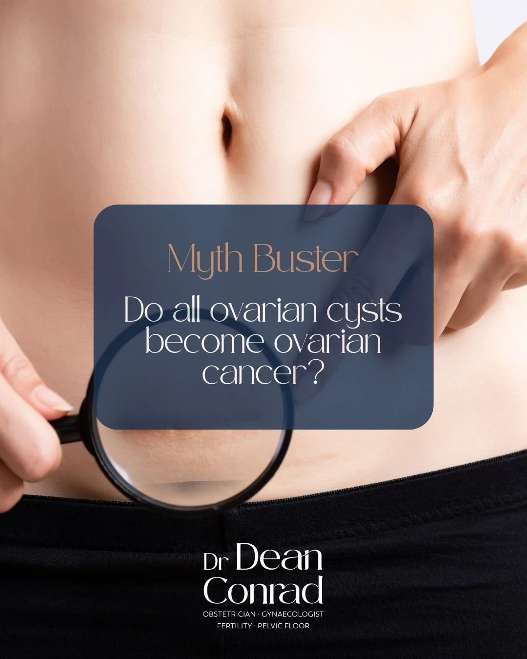 Myth: Do all Ovarian cysts become ovarian cancer?

Fact:  No
The vast majority of ovarian cysts are benign and do NOT turn into cancer.
Ovarian cysts are very common&mdash;especially during reproductive years&mdash;and most are related to normal ovul