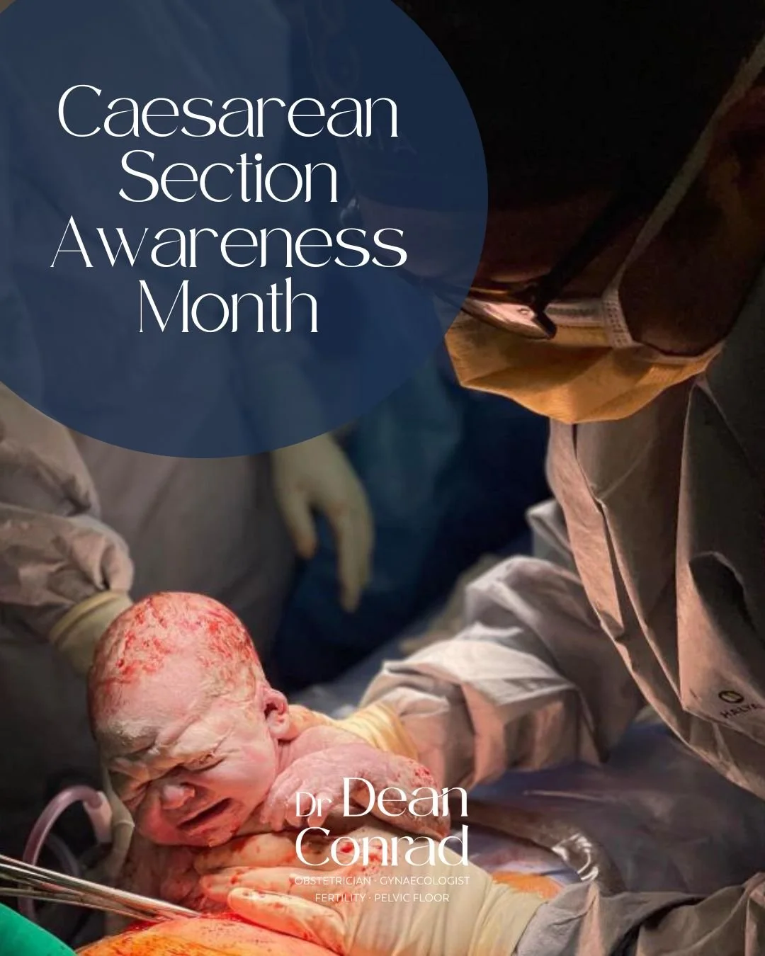 April is Caesarean Awareness Month.

A caesarean section is one of the most common operations performed worldwide, and a significant part of many families&rsquo; birth stories. Sometimes it&rsquo;s planned, sometimes it&rsquo;s unexpected, but it is 