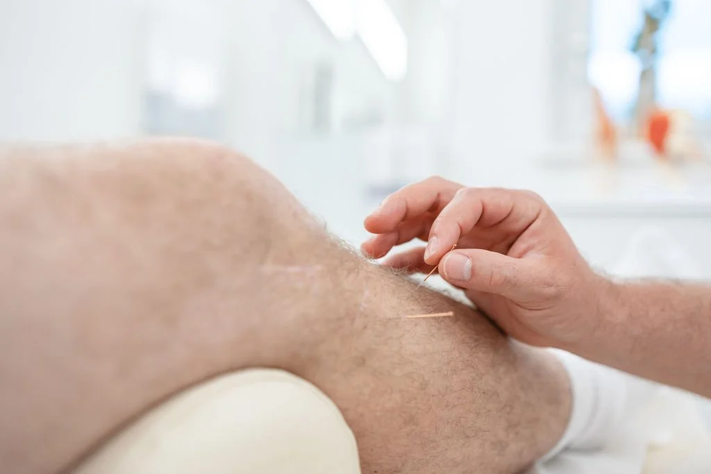 Ablauf einer Akupunktursitzung bei Knieproblemen