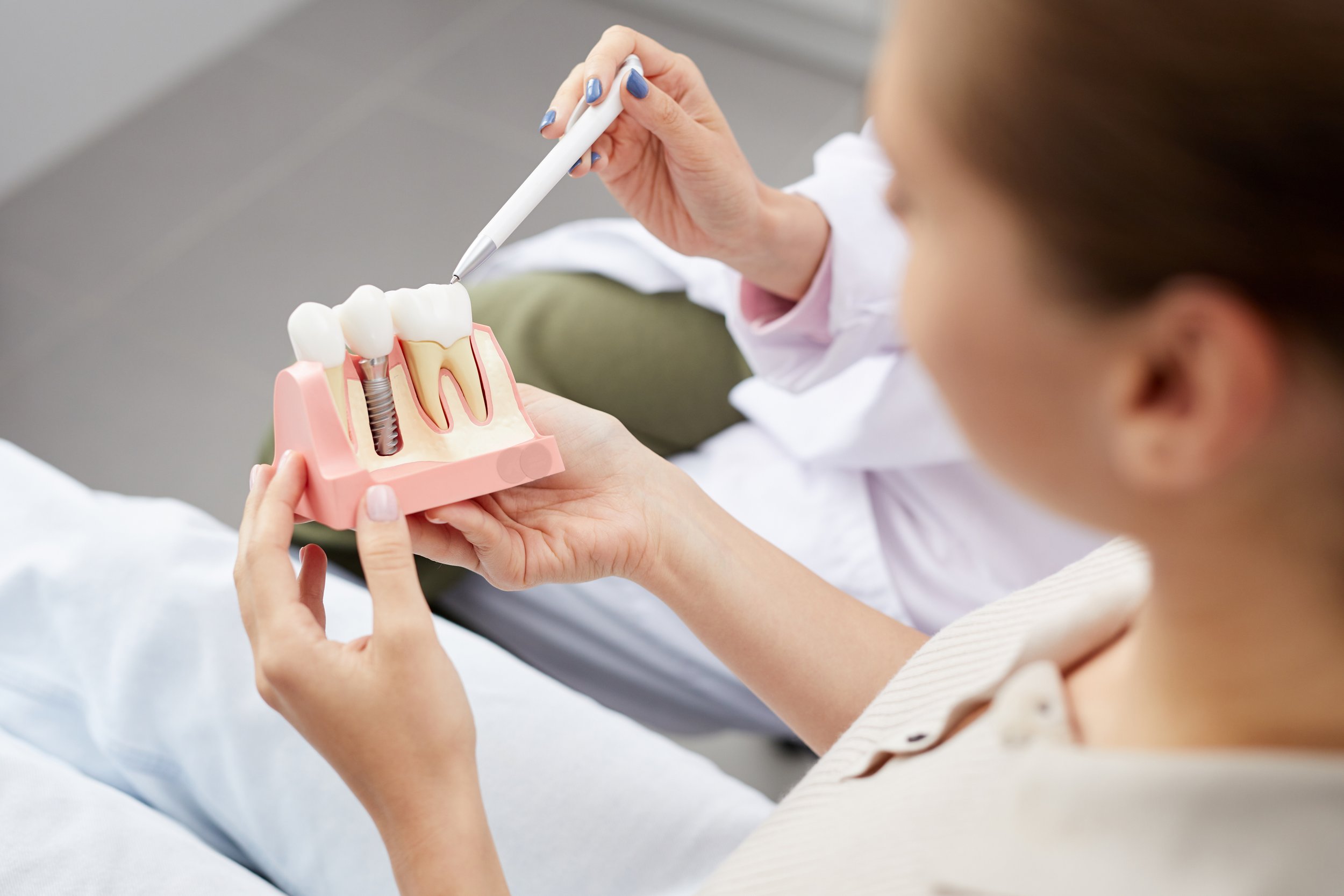 Dentis showing patient model of implants. Full mouth dental implant costs range from $17,000 to $90,000+. This guide breaks down every option — All-on-4, fixed bridges, and implant-supported dentures — so you can compare pricing with confidence.