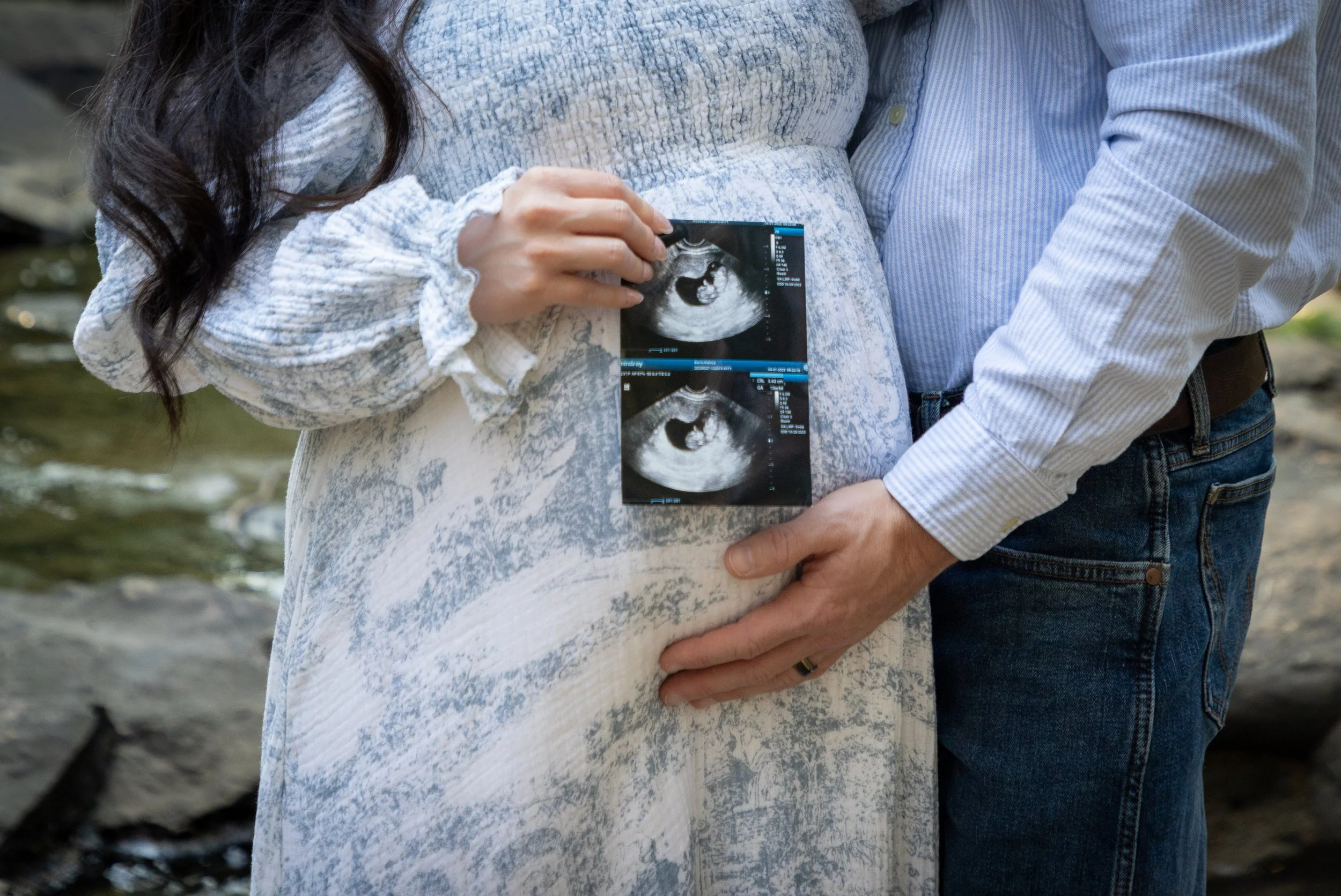 A pregnant woman holding ultrasound images of her baby, with her partner supporting her.