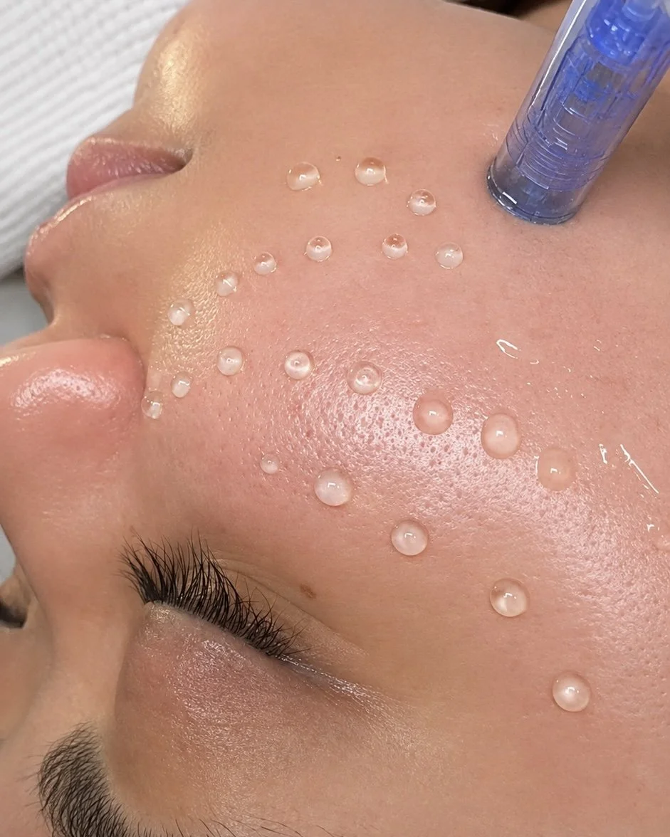 Nano needling nourishing and anti-aging facial treatment at Thao SD Brow & Lash in San Diego