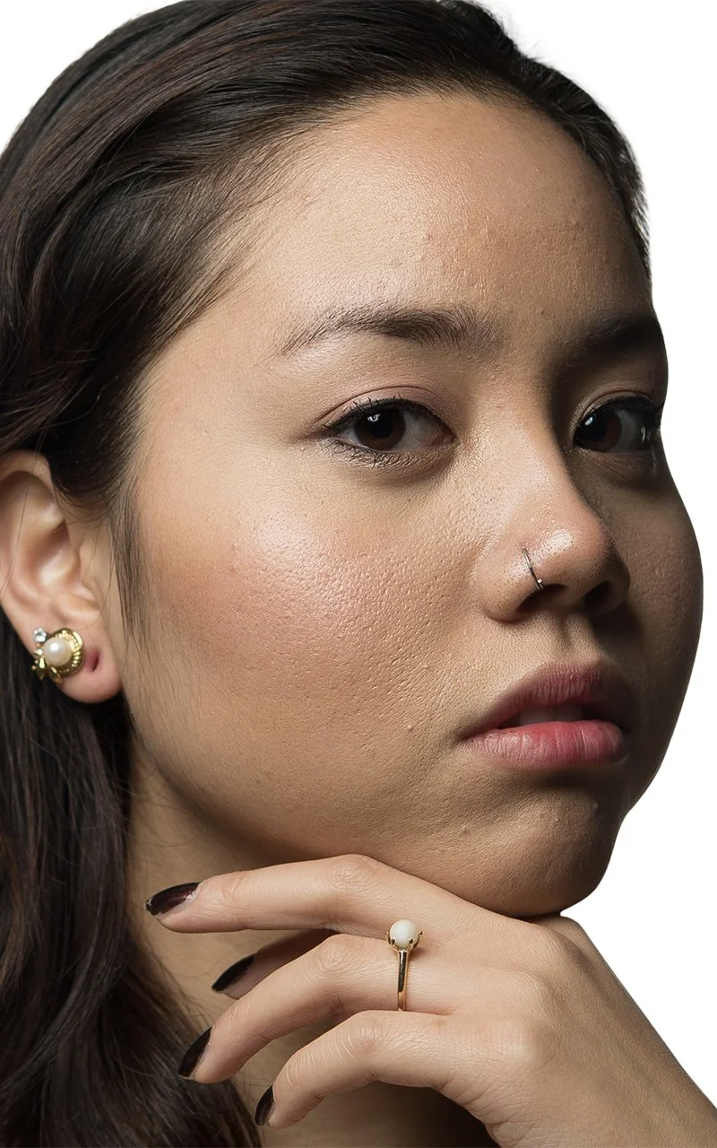 20151121_skin_24_before.jpg