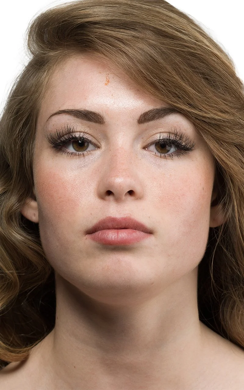 20150406_skin_01_before.jpg