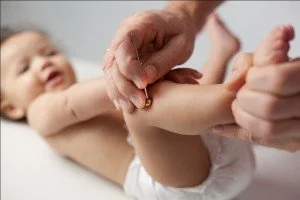 A baby lying on their back receiving a Japanese shonishin treatment