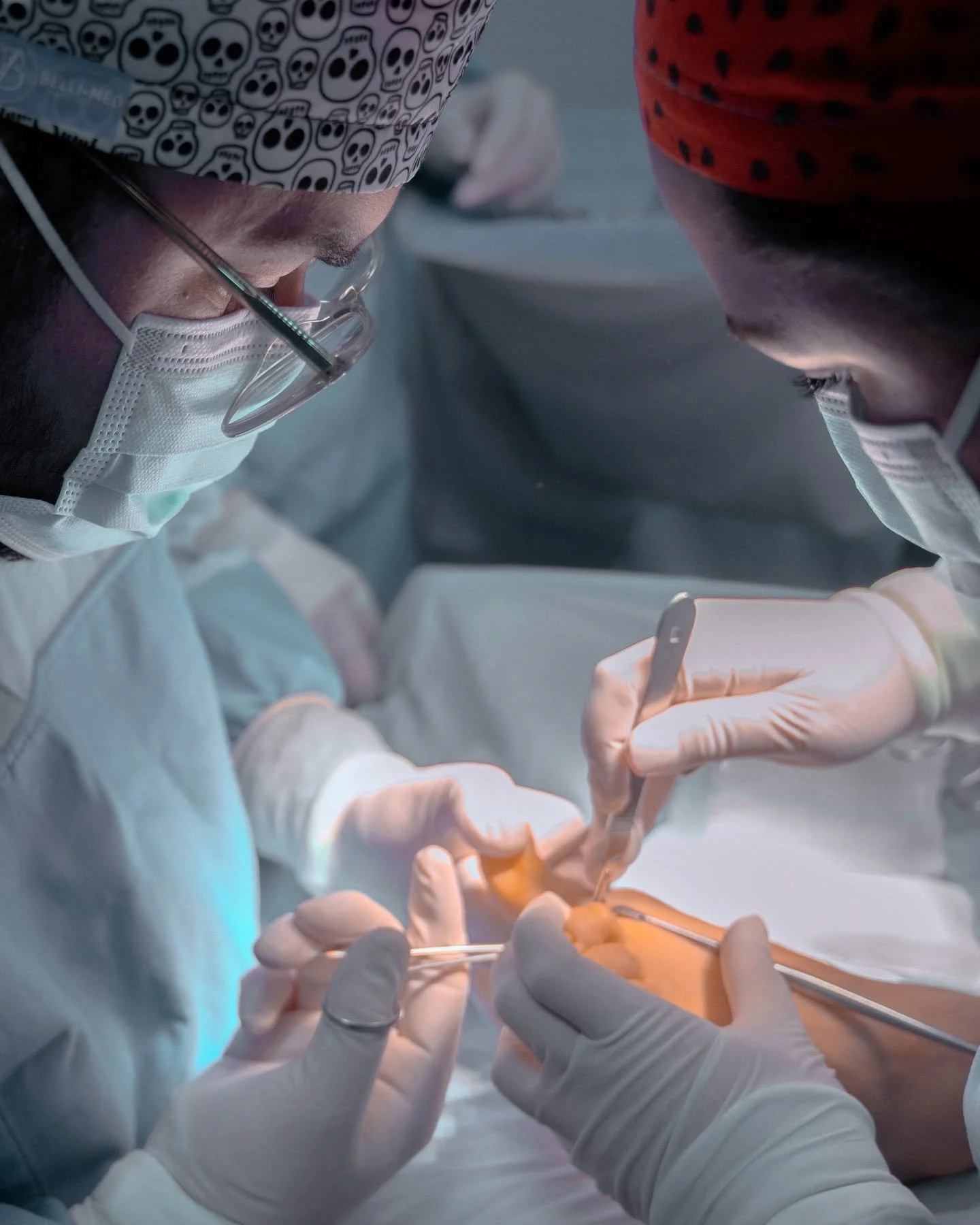 Hallux Valgus (Juanetes). 
Una afecci&oacute;n que, m&aacute;s all&aacute; de lo est&eacute;tico, genera dolor cr&oacute;nico y limita actividades tan fundamentales como caminar o calzarse.
Utilizando las t&eacute;cnicas m&aacute;s avanzadas en cirug