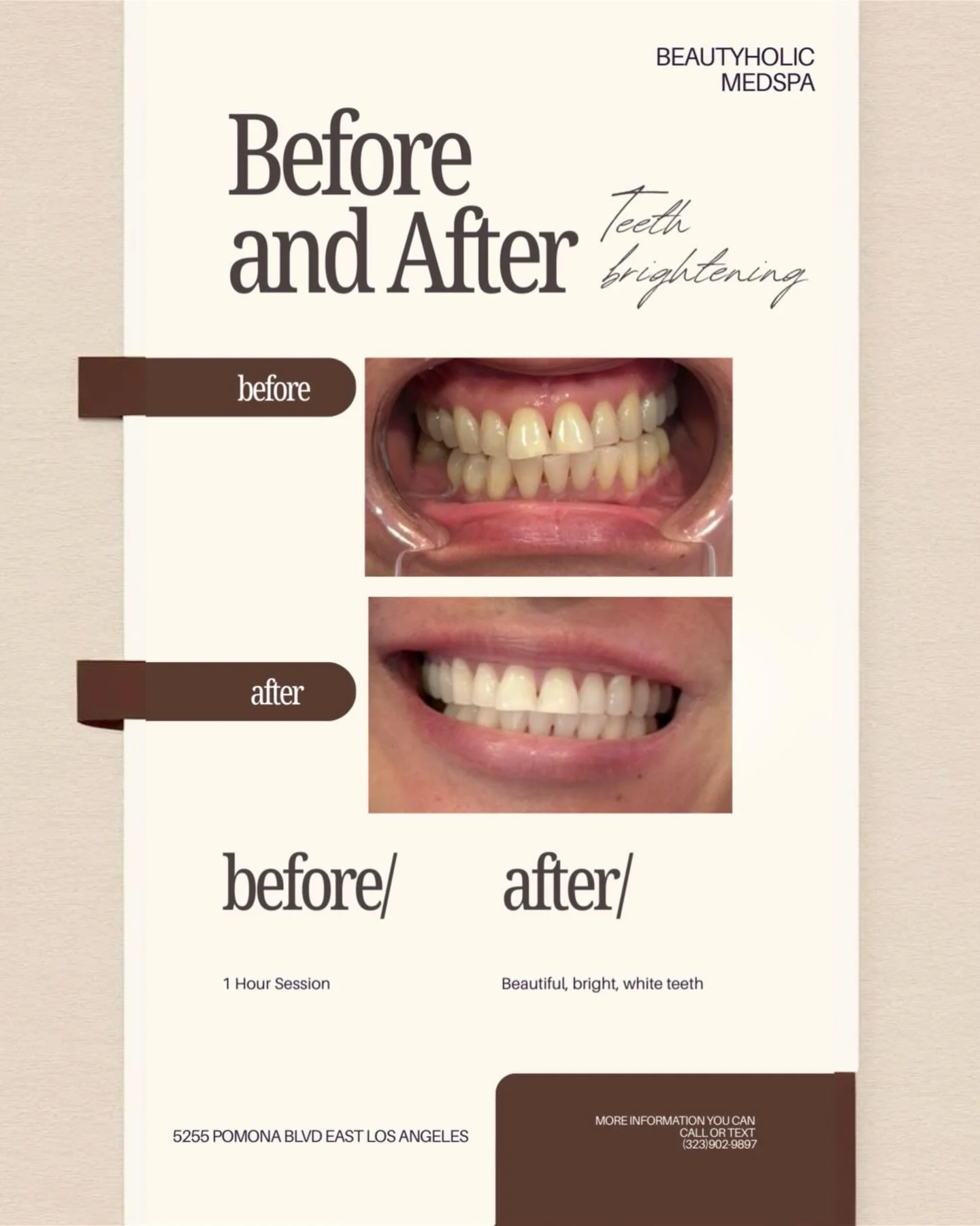 $99 for 1 Hour! Book your pearly whites 🦷🦷🤍😍