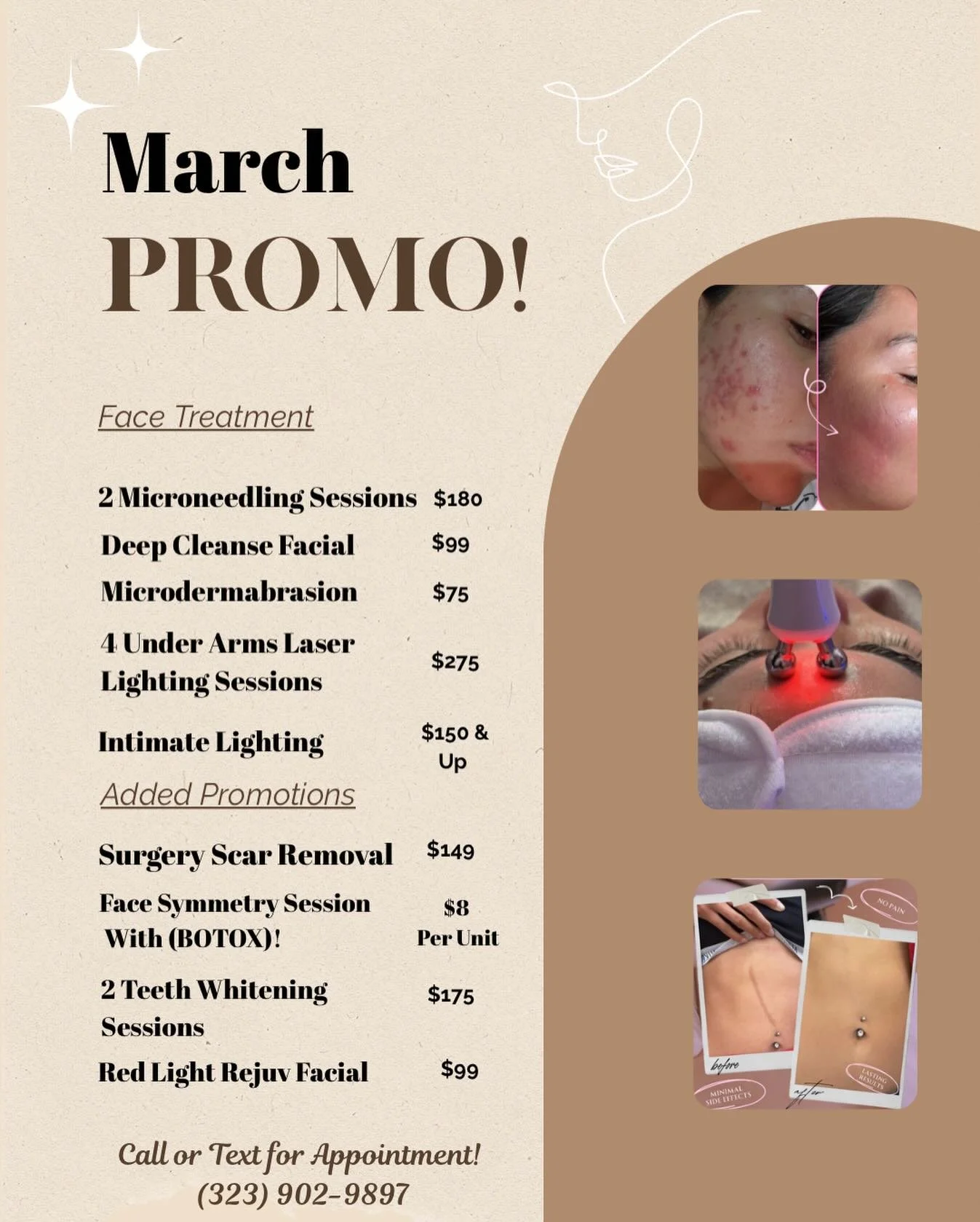 March Promo has arrived! 🤍😍✨🫶🏻