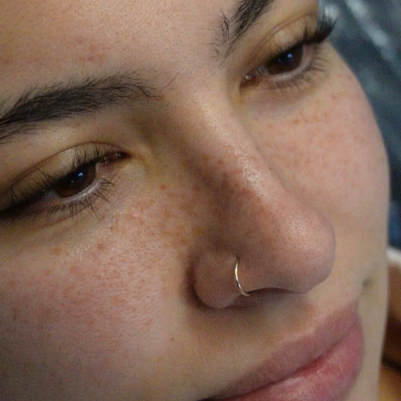 Healed Freckle Tattoo 🧚&zwj;♀️✨
(2 year fade out - Heavy Coverage)

Last frame is fresh post coverage upgrade touch up 

📆
Fully Booked through February
March appointments open 2/1 at 12pm pst on a first come first reserved basis 

👩&zwj;🏫
Freckl