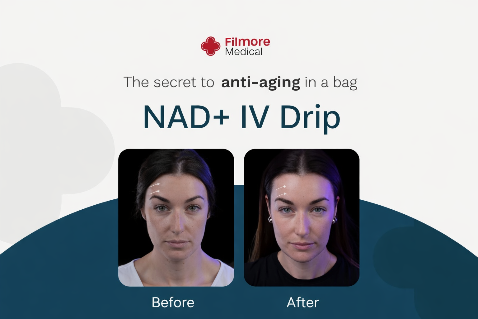 NAD+ IV Drip: Rahasia Anti-Aging, Energi, dan Fokus dalam Satu Terapi