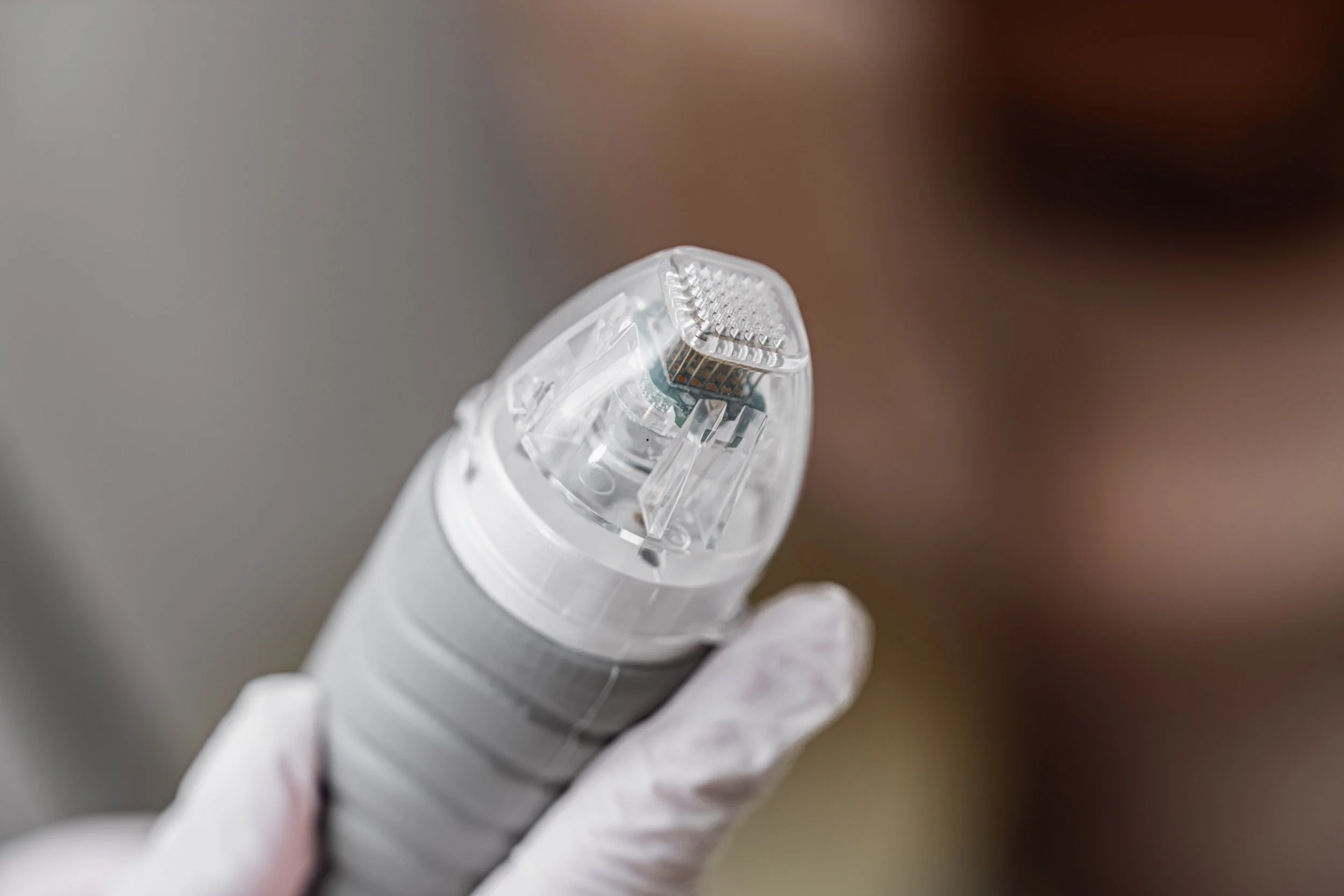 Vaginal PRP dan Vaginal Exosome Microneedling di Filmore Medical