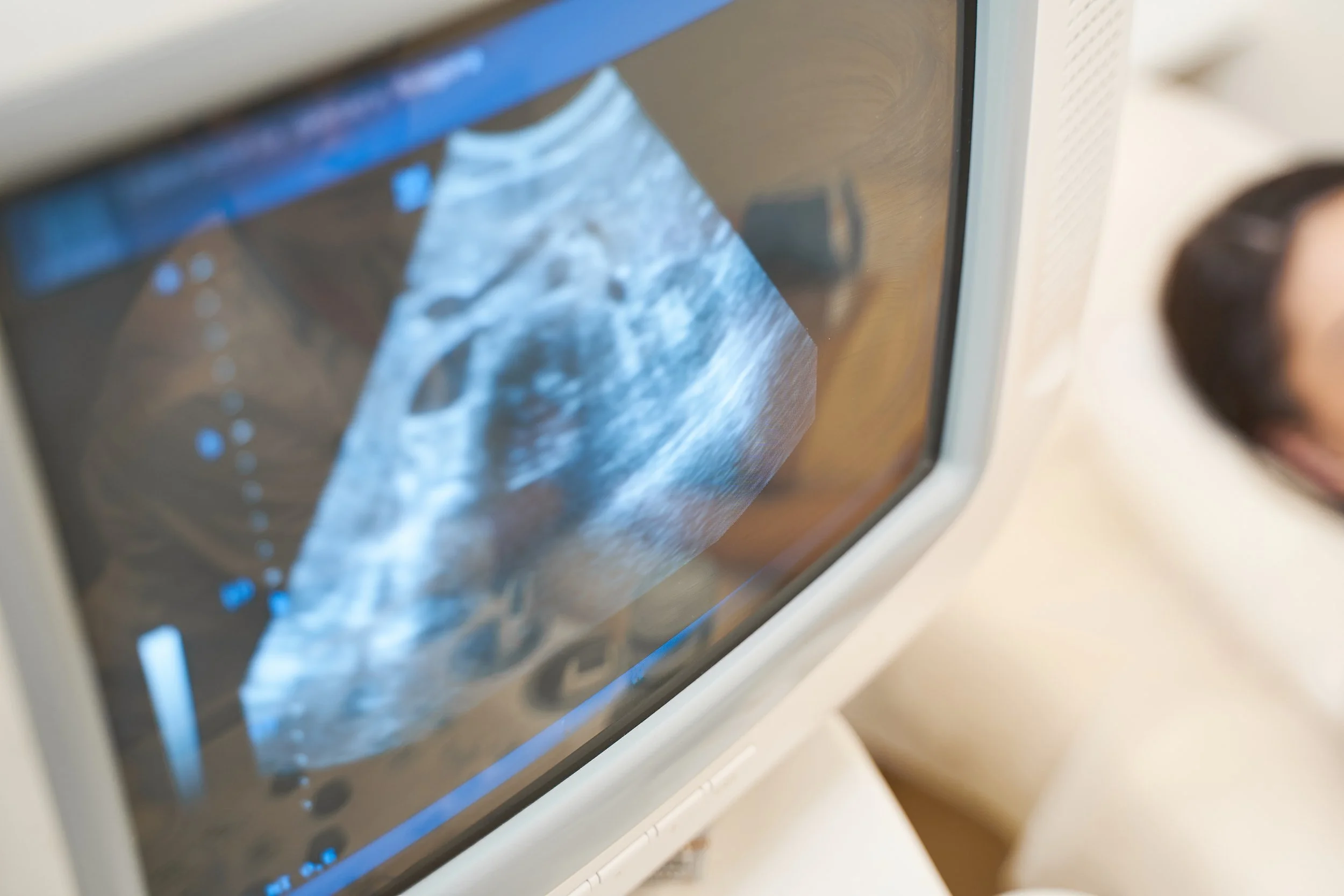 USG Fetomaternal dengan Subspecialist Fetomaternal di Filmore Medical