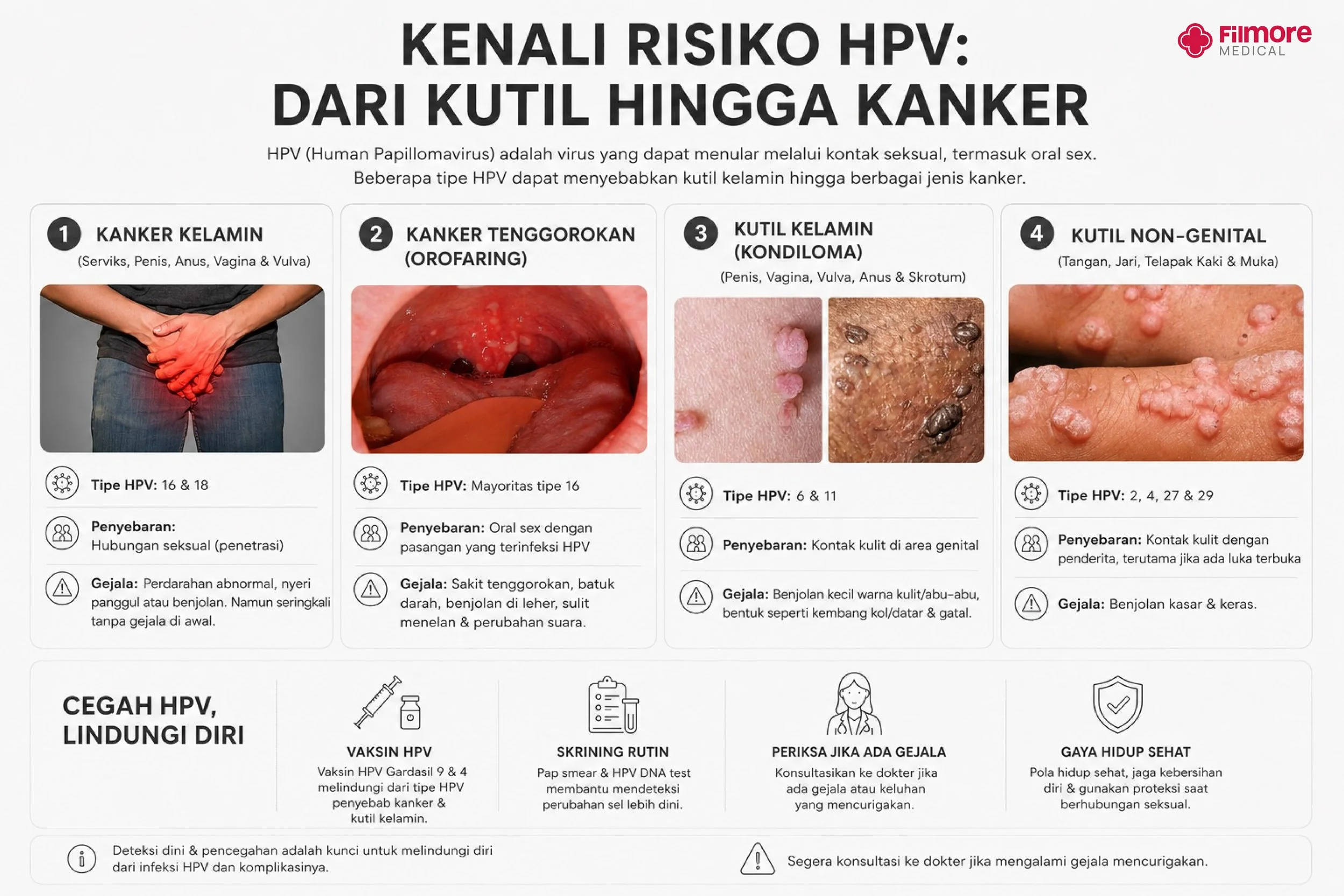 Benarkah Oral Sex Bisa Menyebabkan Kanker Tenggorokan? Ini Hubungannya dengan HPV