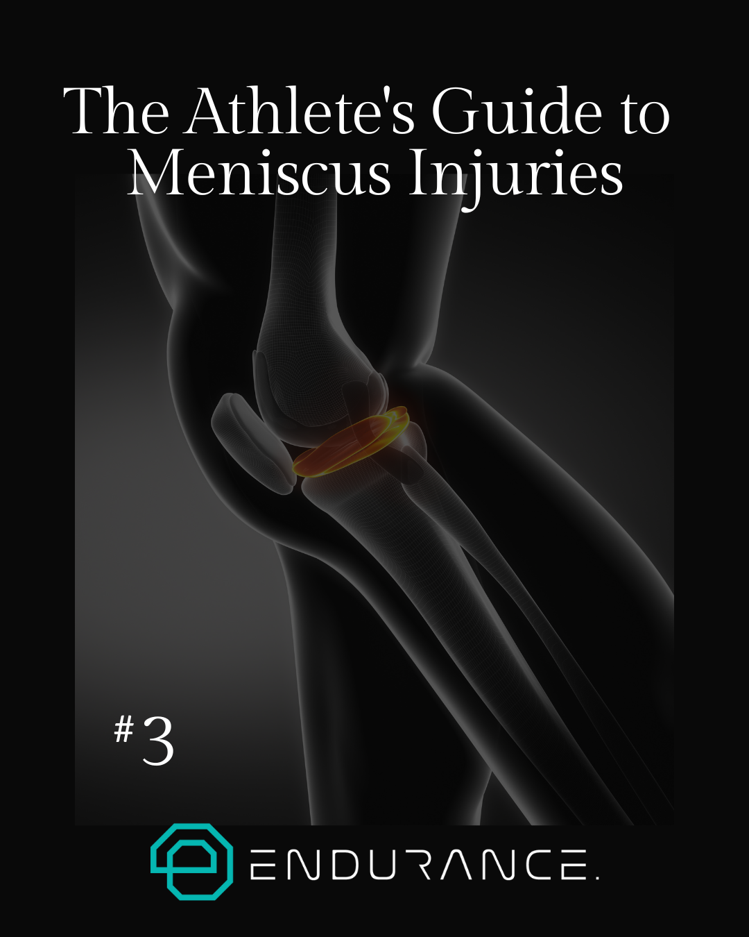 Blog 3: The Athlete's Guide to Meniscus Injuries 