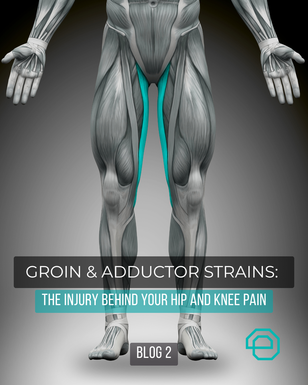 Blog 2: Groin &amp; Adductor Strains: The Injury Behind Your Hip and Knee Pain 