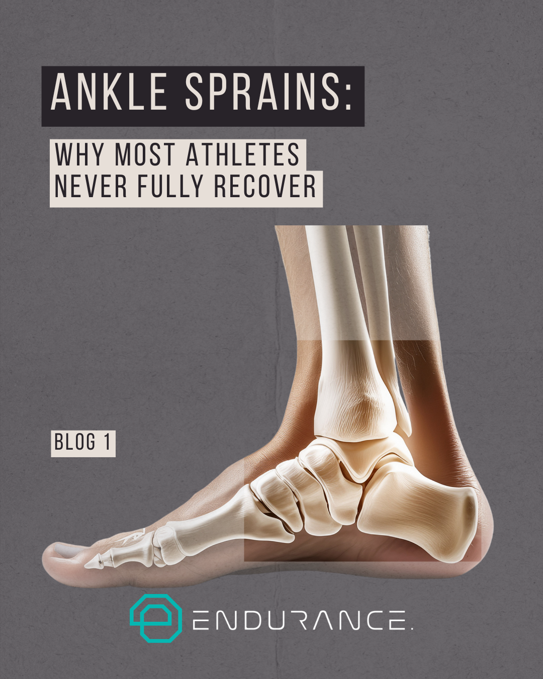 Blog 1: Ankle Sprains: Why Most Athletes Never Recover