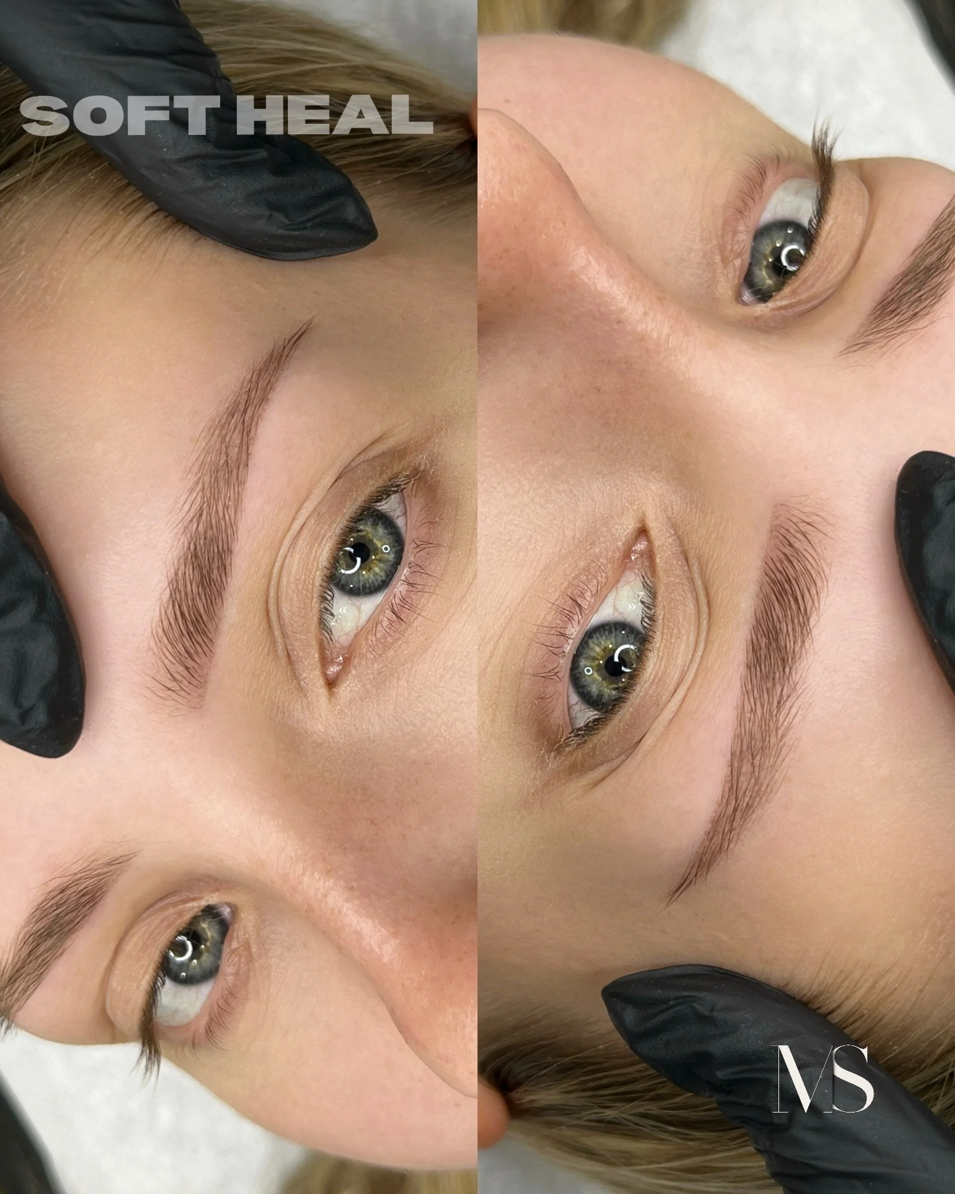 SoftHeal Technique 🩷

The way your work heals beautifully - soft, even and true to tone.

SoftHeal isn&rsquo;t just about creating beautiful brows on the day of the treatment - it&rsquo;s about how they heal naturally, evenly, and flawlessly.