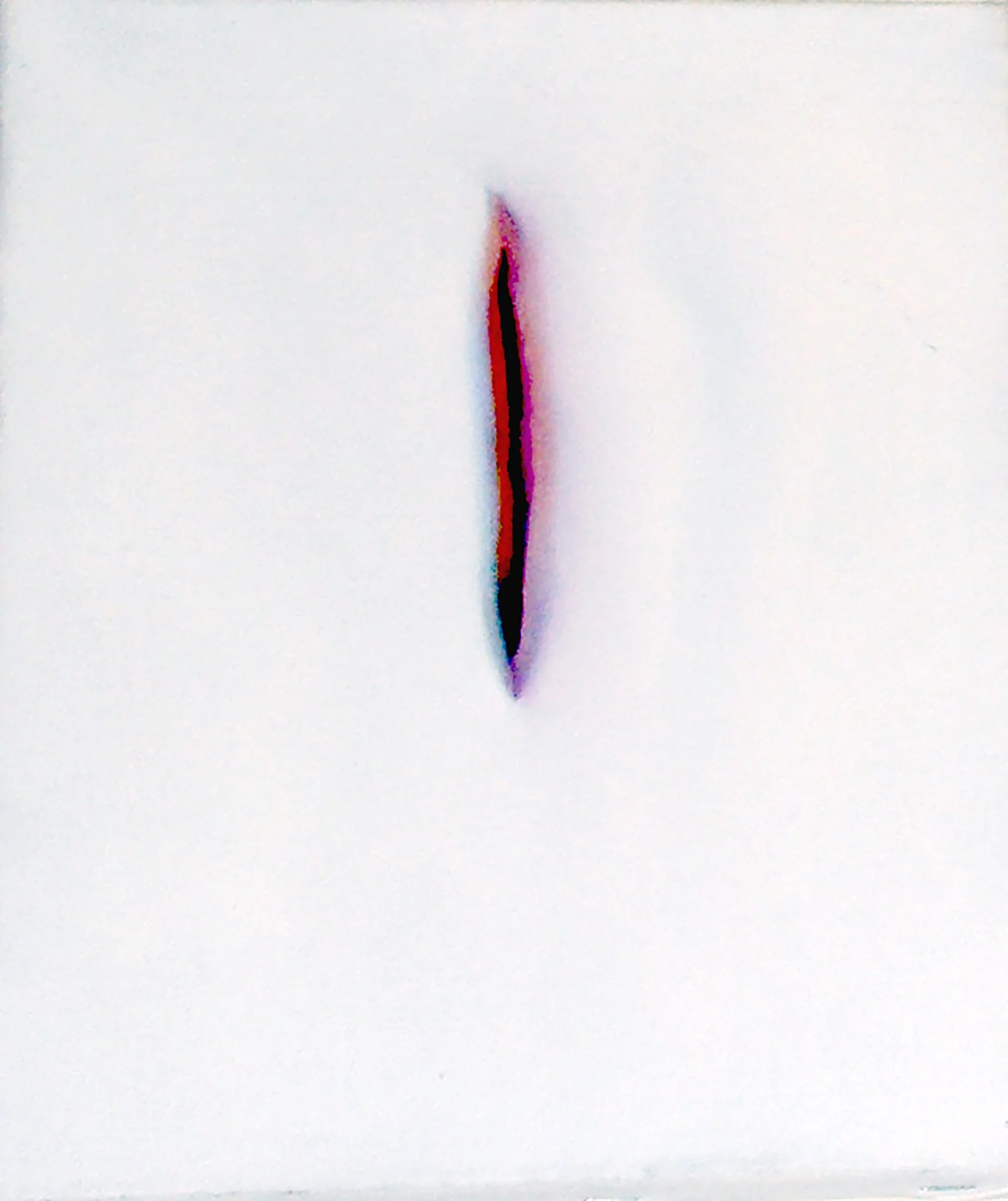 o 1548 wound copy.jpg