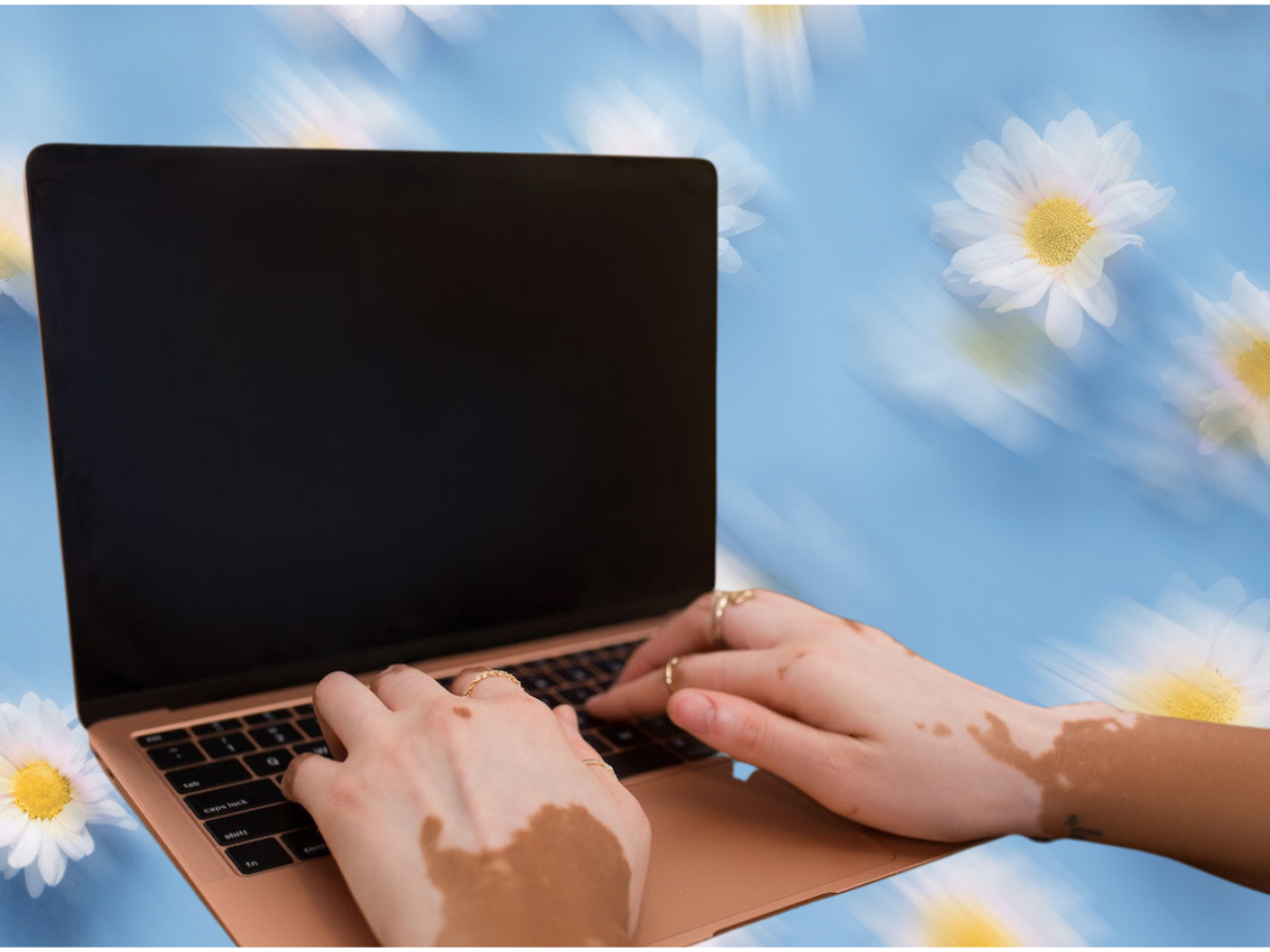 Two hands type on a laptop in front of a blurry blue background with daisies.