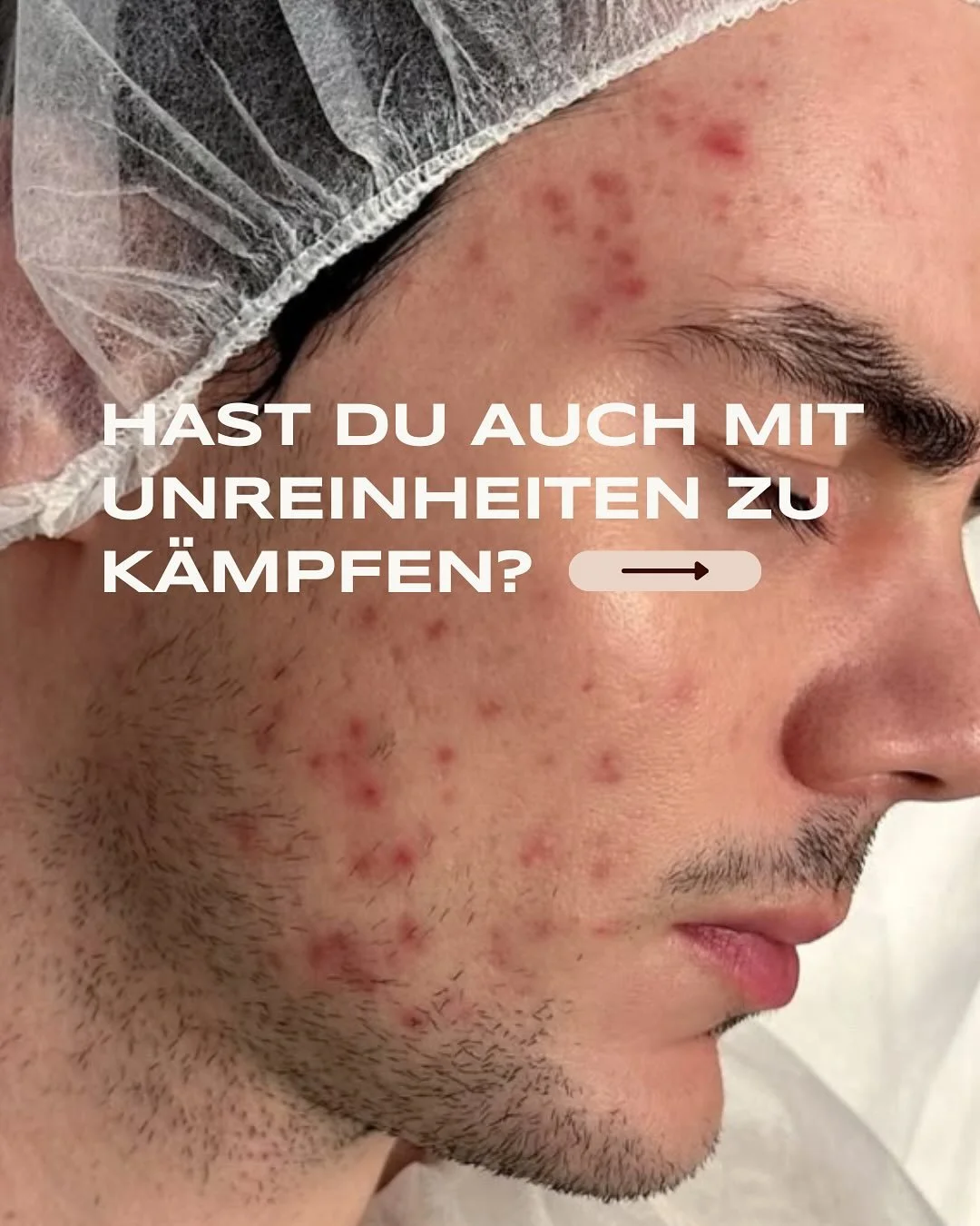 Resultat nach 2 Behandlungen. Book now!