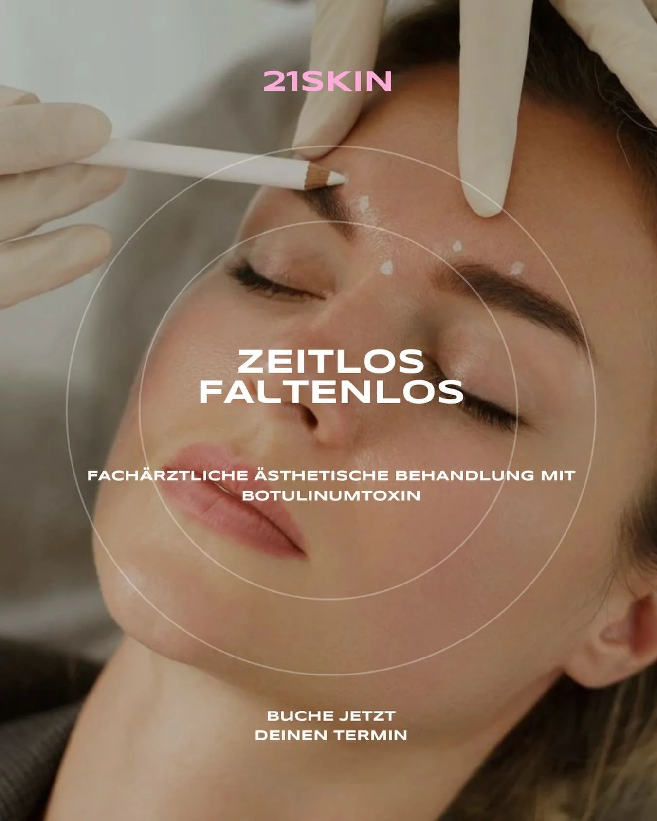 Die Behandlung mit Botulinumtoxin reduziert gezielt mimische Falten und sorgt f&uuml;r ein frisches, entspanntes und nat&uuml;rliches Erscheinungsbild.