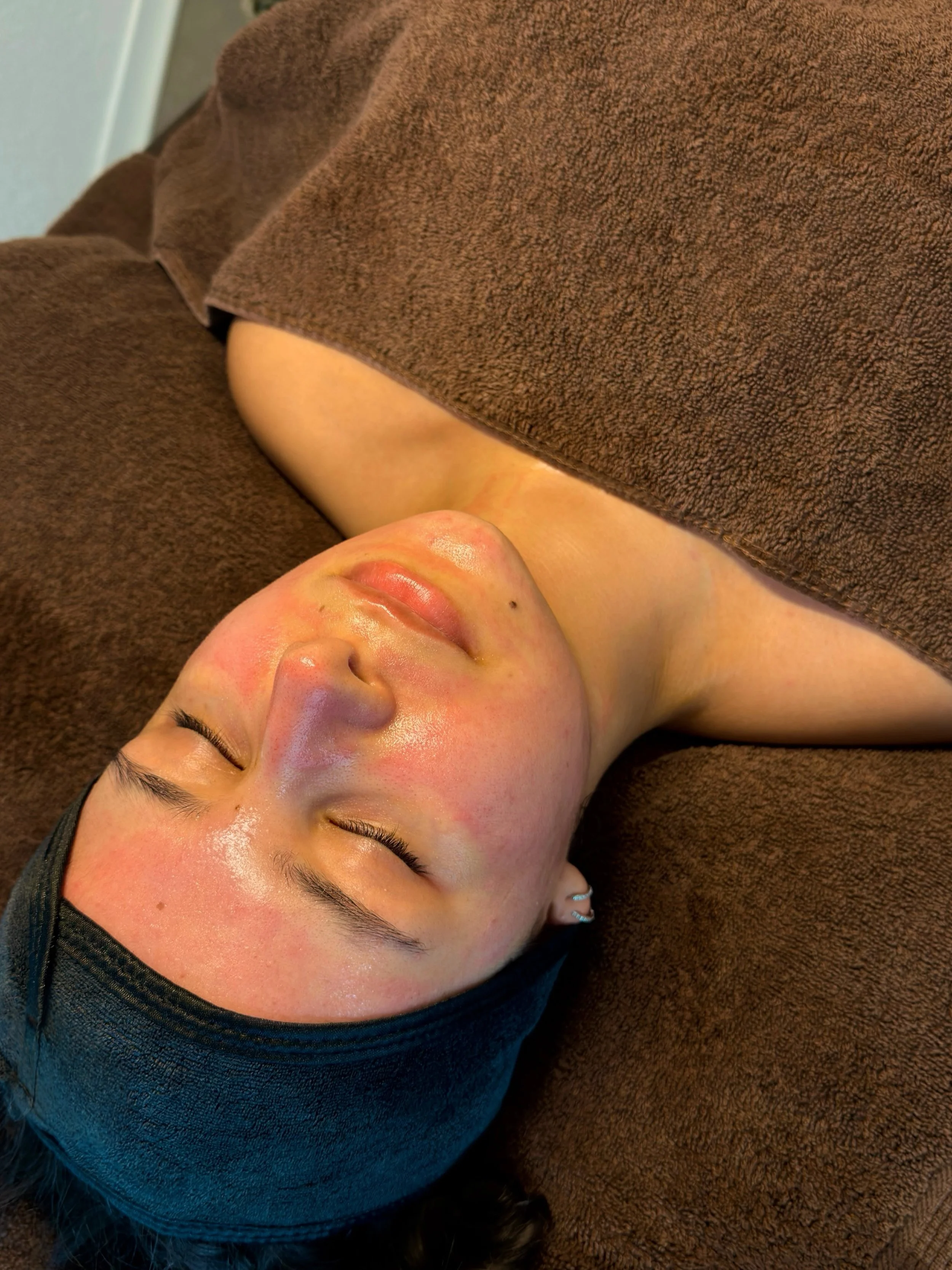 The only trauma a girl needs&hellip;.Microneedling💅