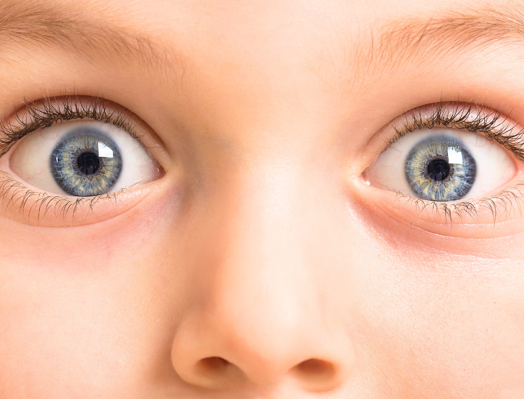 Disagi visivi nei bambini: gli occhiali sono davvero l'unica soluzione?