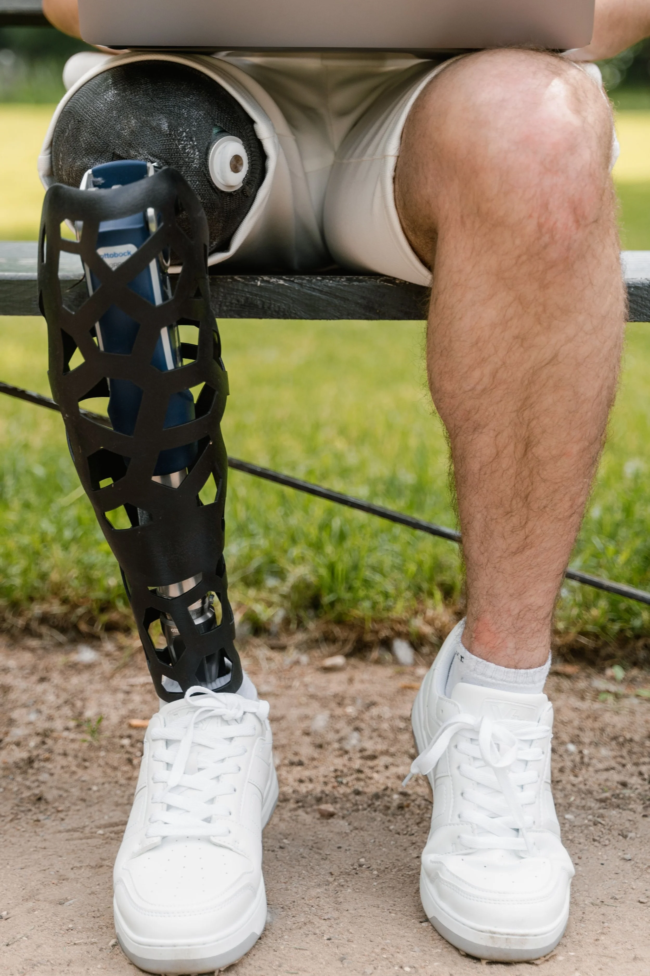 Person with a prosthetic leg sitting on a bench outdoors, representing amputation and limb loss