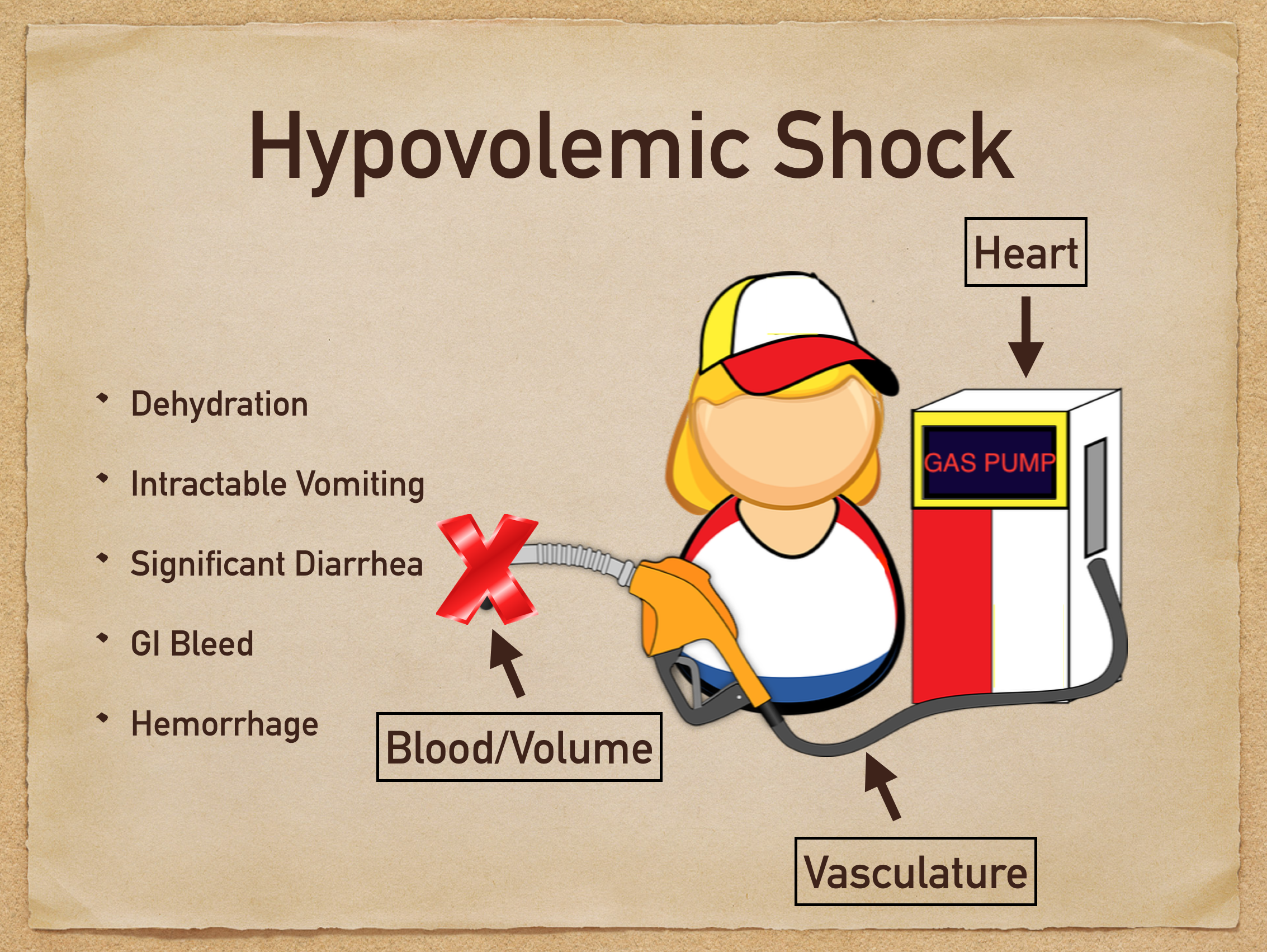 hypovolemic shock