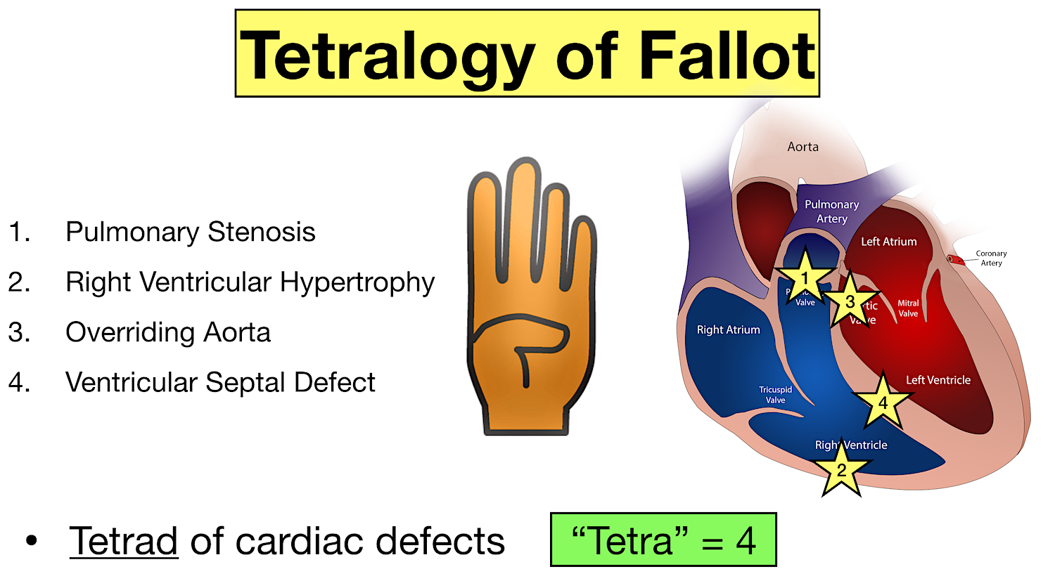 tetralogy of fallot cyanotic congenital heart defect disease definition
