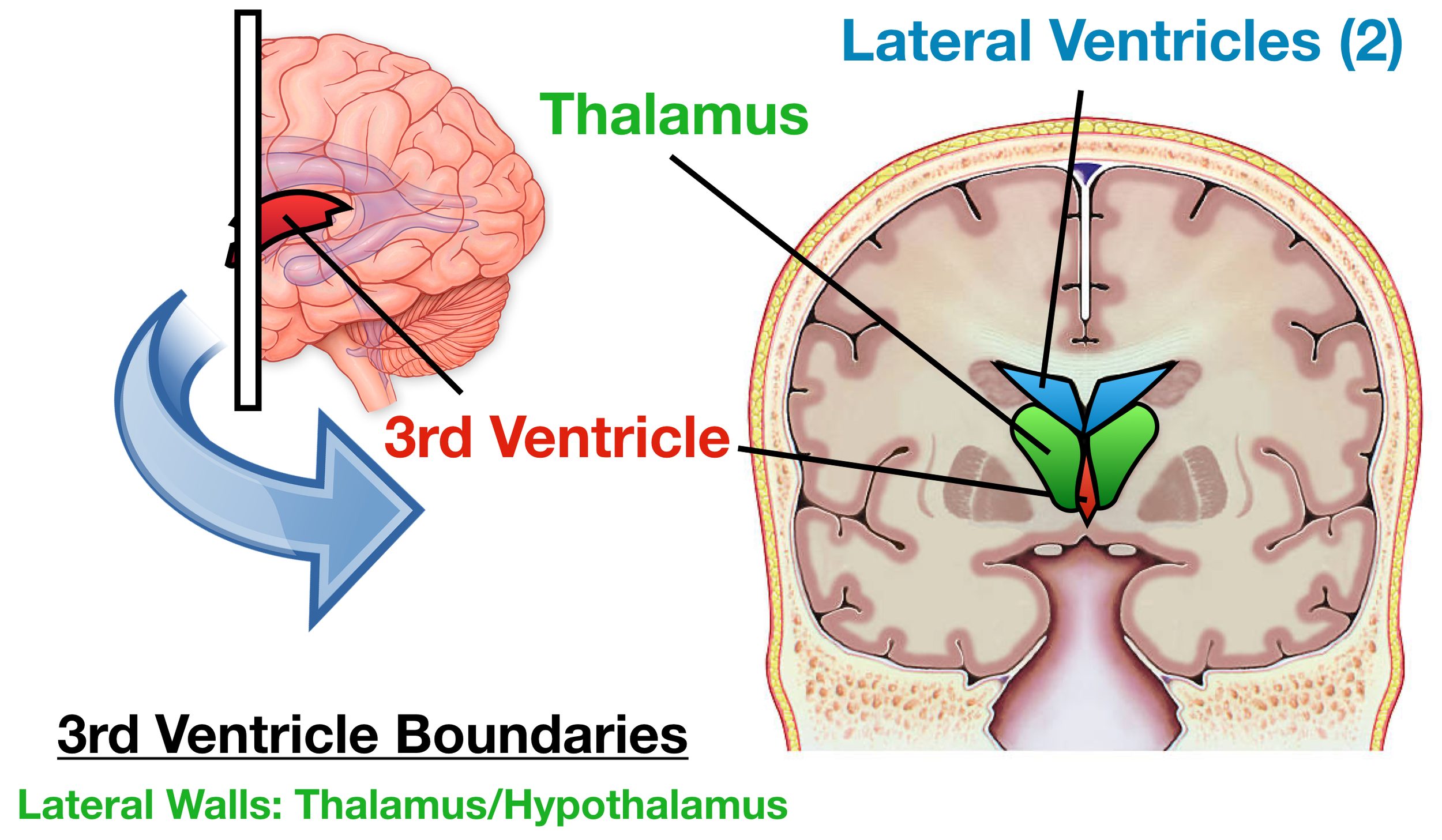 Image (Coronal/Frontal View): The lateral walls of the third ventricle are formed by the 2 thalami (and hypothalamus - see next image below).