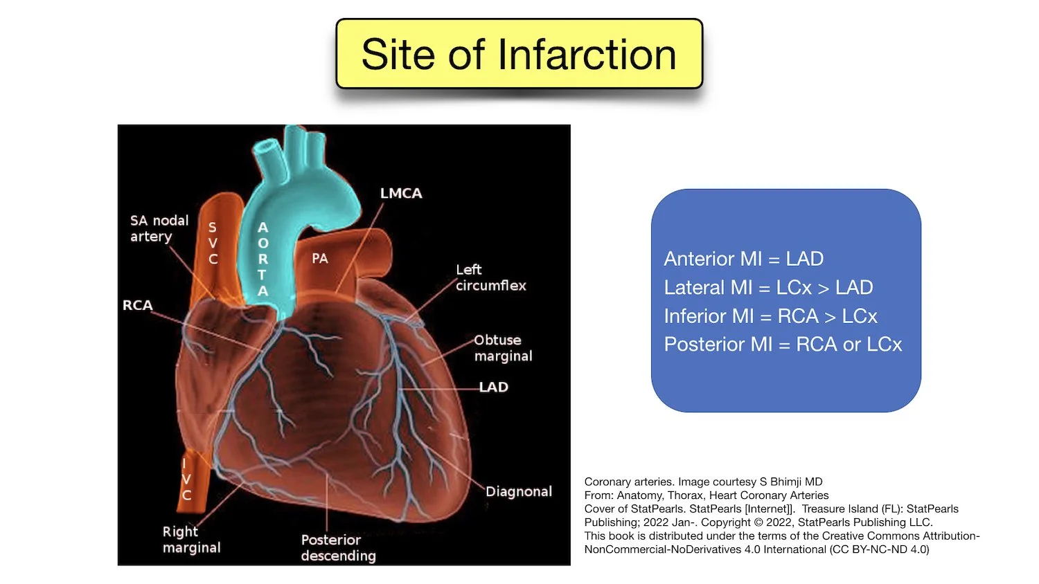 myocardial infarction location chart coronary artery anatomy