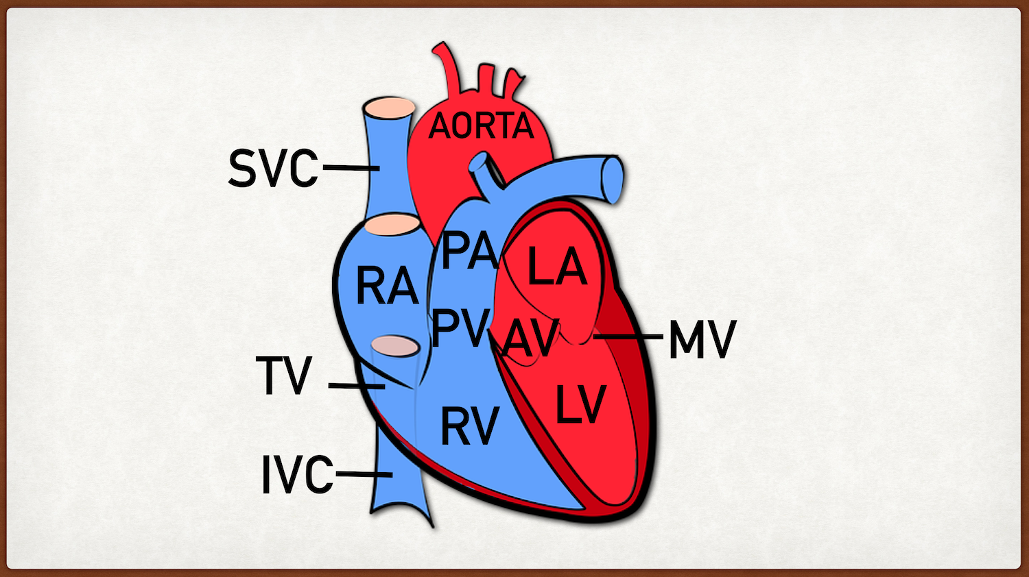 RA = Right Atrium; RV = Right Ventricle; LA = Left Atrium; LV = Left Ventricle; TV = Tricuspid Valve; MV = Mitral Valve; PV = Pulmonic Valve; AV = Aortic Valve; SVC = Superior Vena Cava; IVC = Inferior Vena Cava; PA = Pulmonary Artery (main)