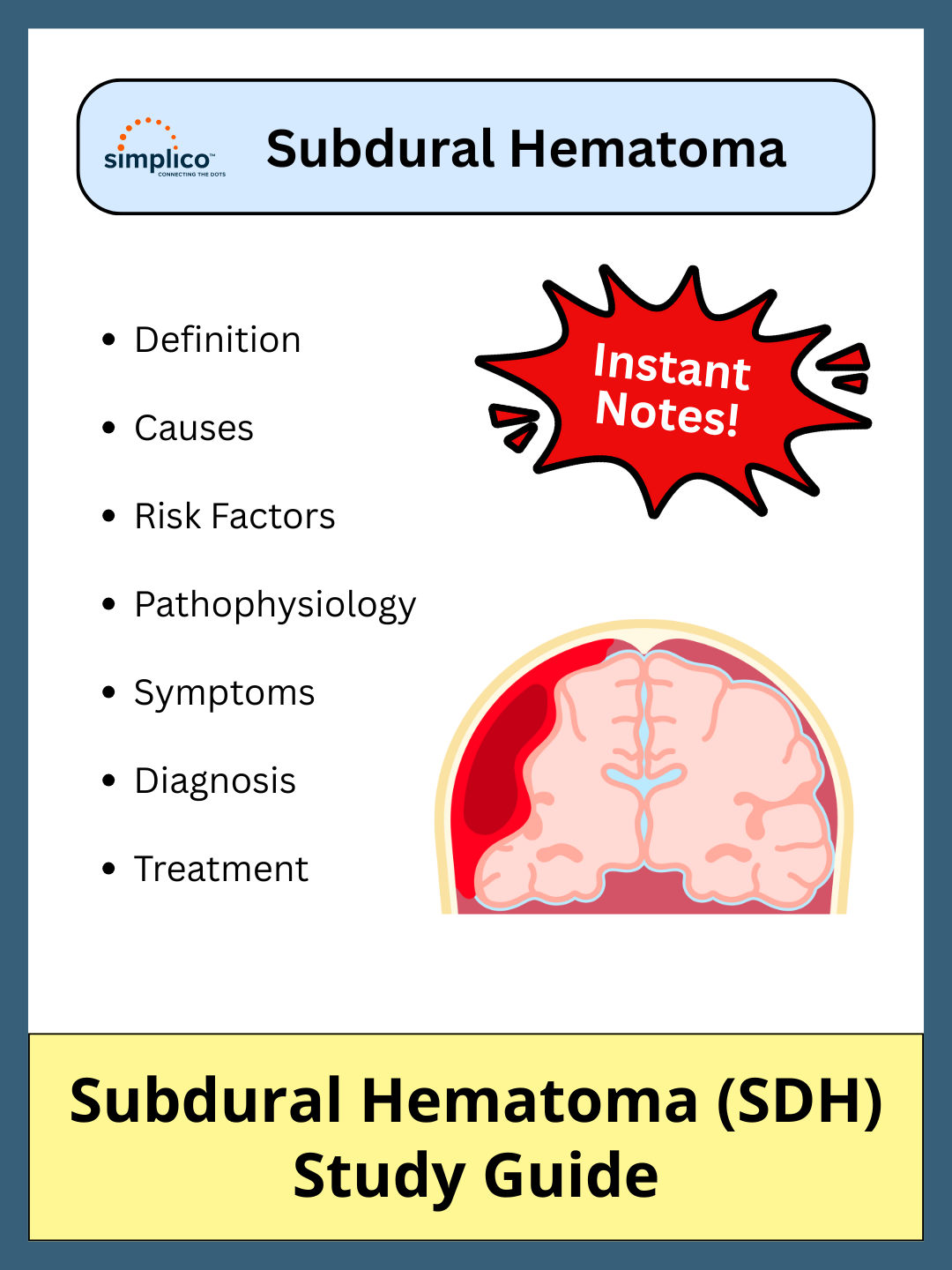 Subdural Hematoma - Study Guide