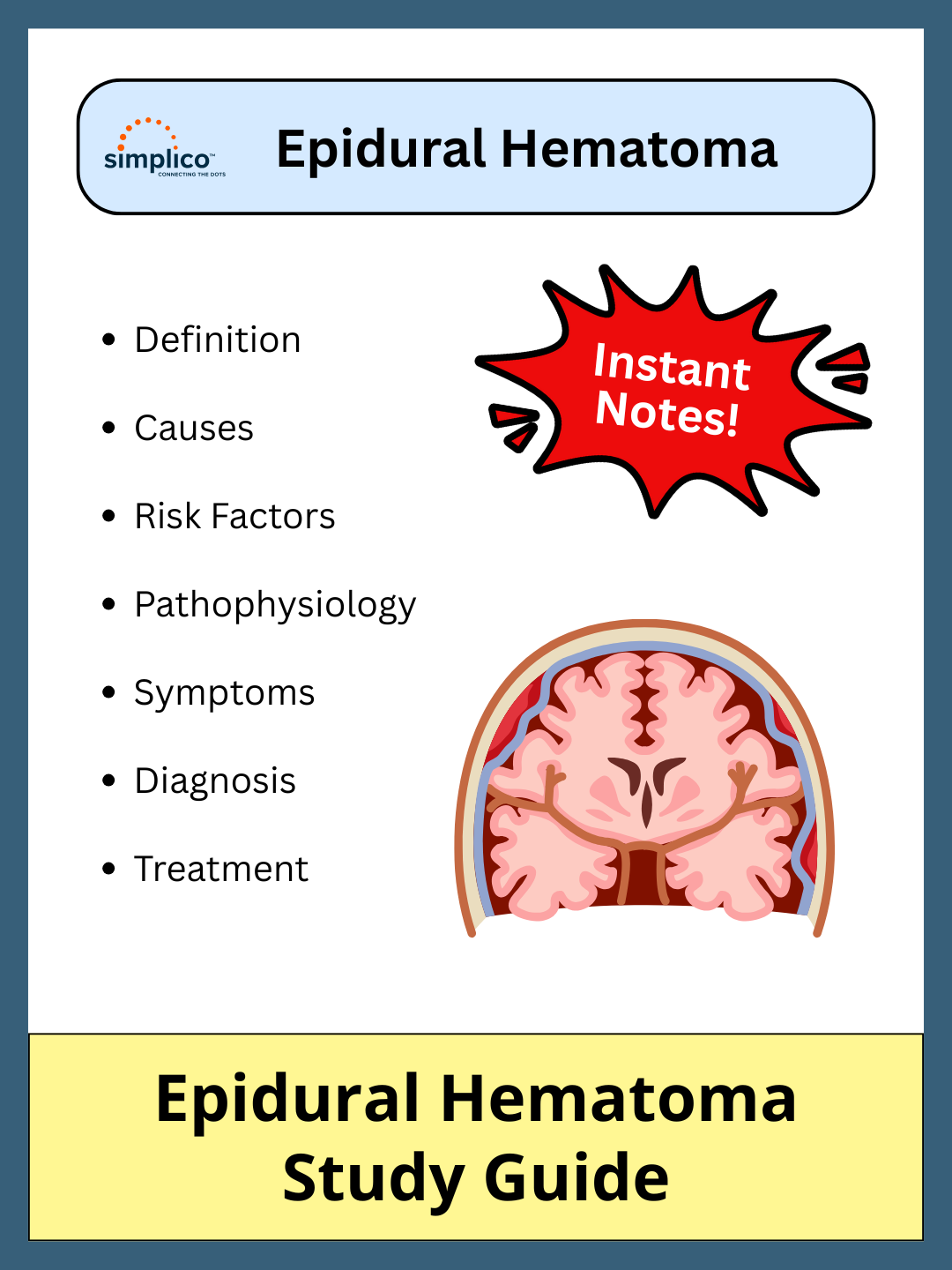 Epidural Hematoma - Study Guide