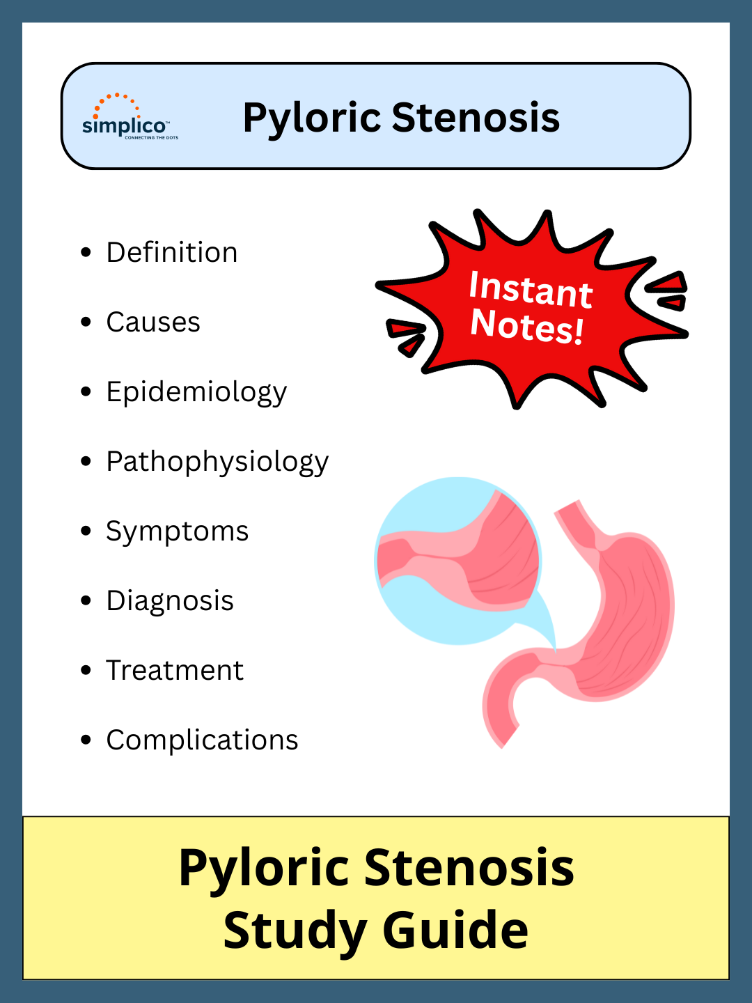 Pyloric Stenosis - Study Guide