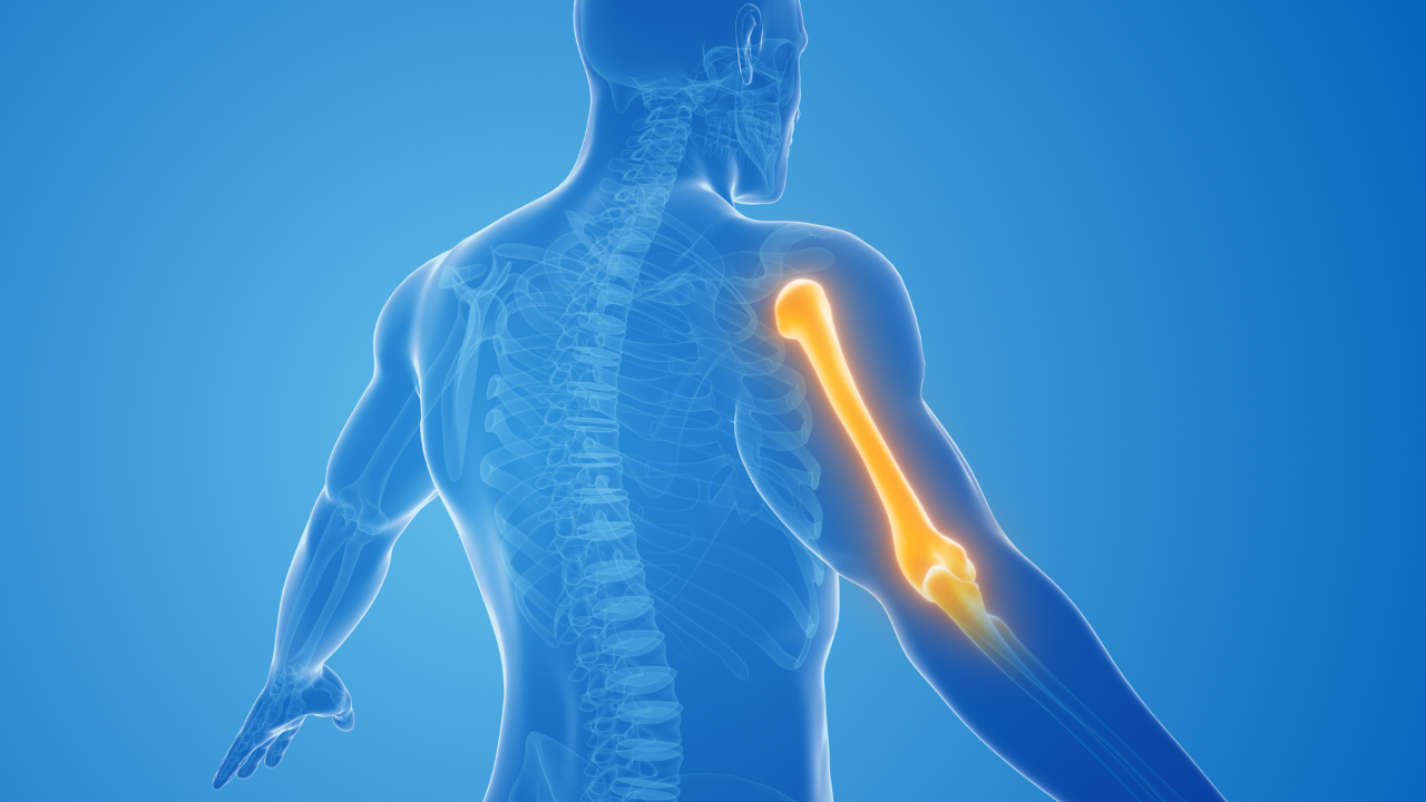 Upper Extremity Nerve Injuries: The Broken “ARM”